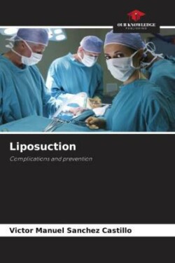 Liposuction