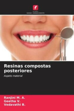 Resinas compostas posteriores