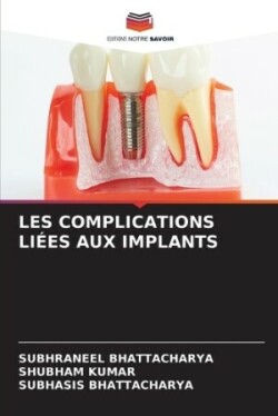 Les Complications Liées Aux Implants