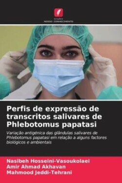 Perfis de expressão de transcritos salivares de Phlebotomus papatasi