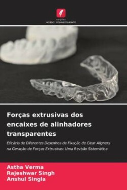 Forças extrusivas dos encaixes de alinhadores transparentes