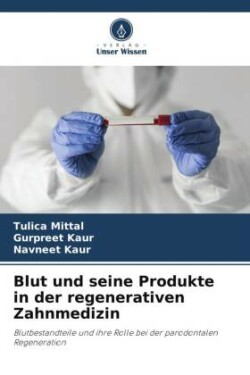 Blut und seine Produkte in der regenerativen Zahnmedizin