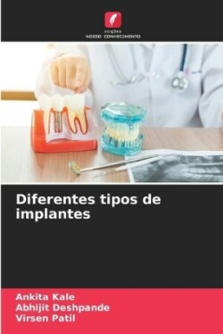 Diferentes tipos de implantes