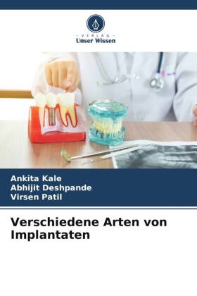 Verschiedene Arten von Implantaten