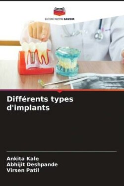 Différents types d'implants