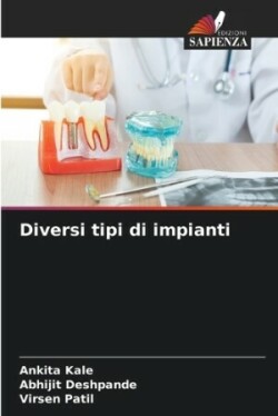 Diversi tipi di impianti