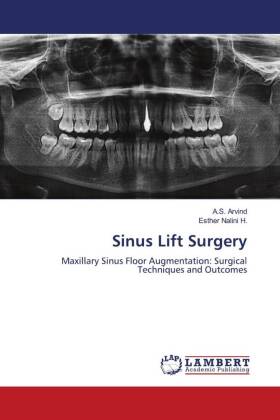 Sinus Lift Surgery