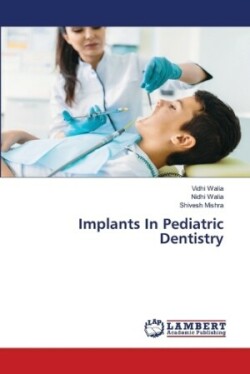 Implants In Pediatric Dentistry