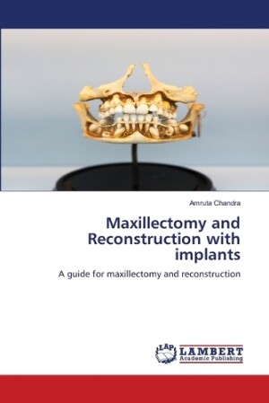 Maxillectomy and Reconstruction with implants