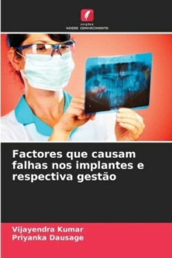 Factores que causam falhas nos implantes e respectiva gestão