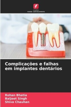 Complicações e falhas em implantes dentários