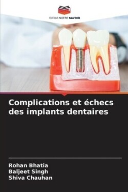 Complications et échecs des implants dentaires