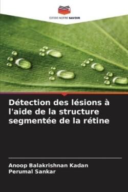 Détection des lésions à l'aide de la structure segmentée de la rétine