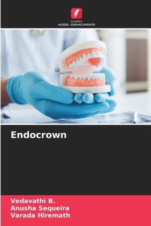 Endocrown