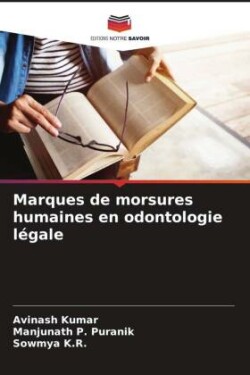 Marques de morsures humaines en odontologie légale