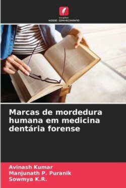 Marcas de mordedura humana em medicina dentária forense