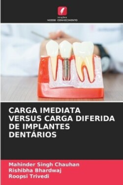 Carga Imediata Versus Carga Diferida de Implantes Dentários