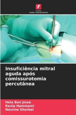 Insuficiência mitral aguda após comissurotomia percutânea