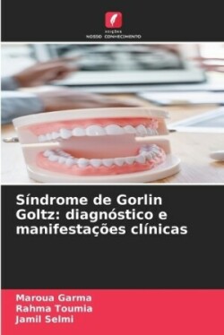 Síndrome de Gorlin Goltz