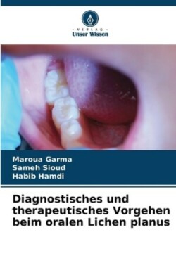 Diagnostisches und therapeutisches Vorgehen beim oralen Lichen planus