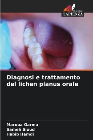 Diagnosi e trattamento del lichen planus orale