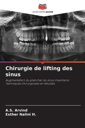 Chirurgie de lifting des sinus