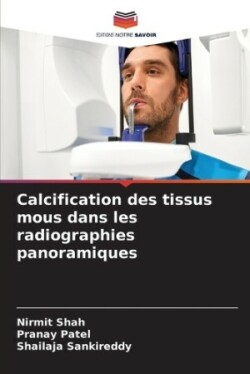 Calcification des tissus mous dans les radiographies panoramiques