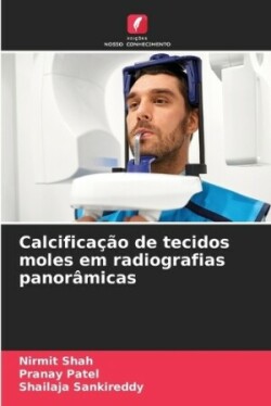 Calcificação de tecidos moles em radiografias panorâmicas