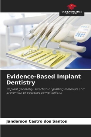 Evidence-Based Implant Dentistry