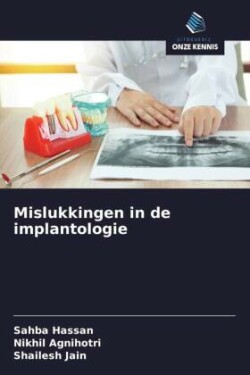 Mislukkingen in de implantologie