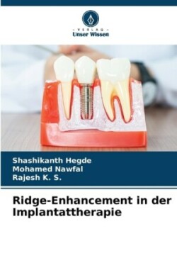 Ridge-Enhancement in der Implantattherapie