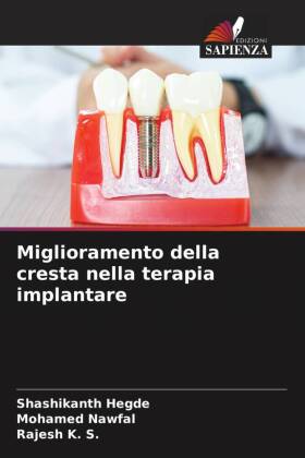 Miglioramento della cresta nella terapia implantare