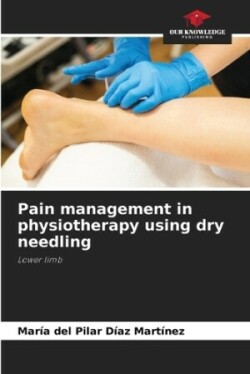 Pain management in physiotherapy using dry needling