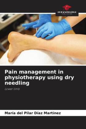 Pain management in physiotherapy using dry needling