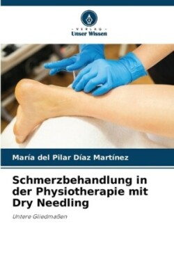 Schmerzbehandlung in der Physiotherapie mit Dry Needling