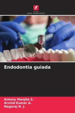 Endodontia guiada