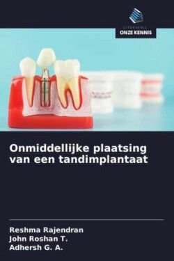 Onmiddellijke plaatsing van een tandimplantaat