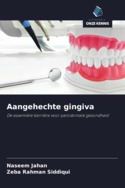 Aangehechte gingiva