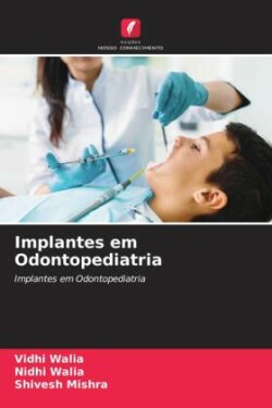 Implantes em Odontopediatria