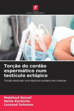 Torção do cordão espermático num testículo ectópico