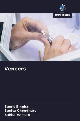 Veneers