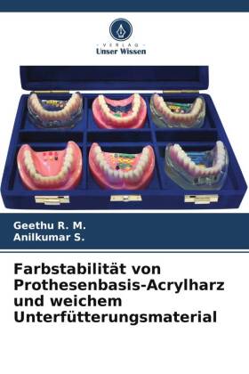 Farbstabilität von Prothesenbasis-Acrylharz und weichem Unterfütterungsmaterial