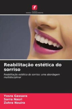 Reabilitação estética do sorriso