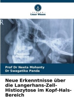 Neue Erkenntnisse über die Langerhans-Zell-Histiozytose im Kopf-Hals-Bereich