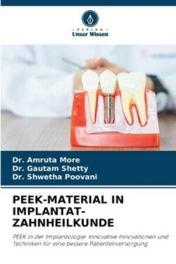 Peek-Material in Implantat-Zahnheilkunde