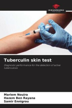 Tuberculin skin test