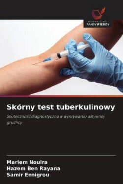 Skórny test tuberkulinowy