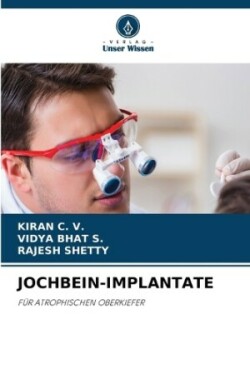 Jochbein-Implantate