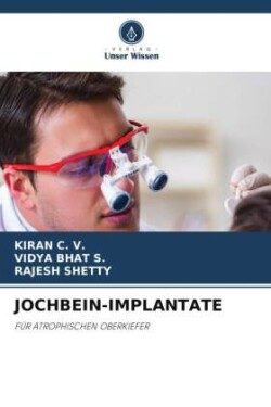 Jochbein-Implantate