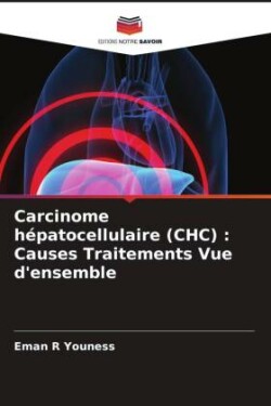 Carcinome hépatocellulaire (CHC)